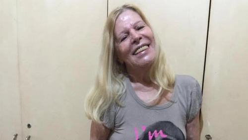 Quadro de saúde de Vanusa permanece estável e cantora continua internada na UTI