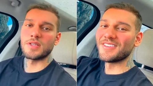Sertanejo Hudson e Wesley Safadão fazem harmonização facial