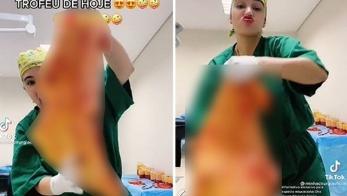 Médica que atende em Ribeirão Preto "brinca" com pele de pacientes operados nas redes sociais