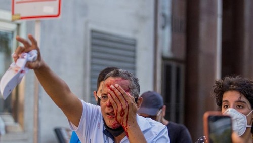 Feridos em protesto contra Bolsonaro vão receber indenização no PE