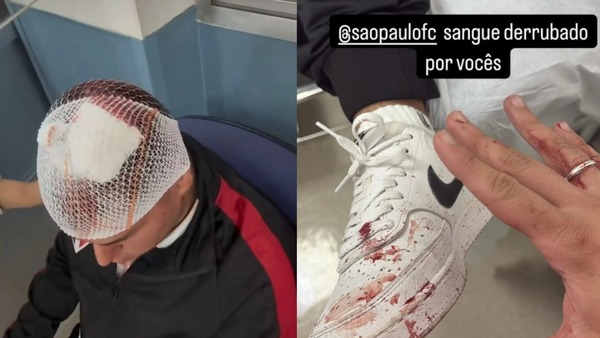 Torcedores acusam São Paulo de negligência após acidente com placa de ferro