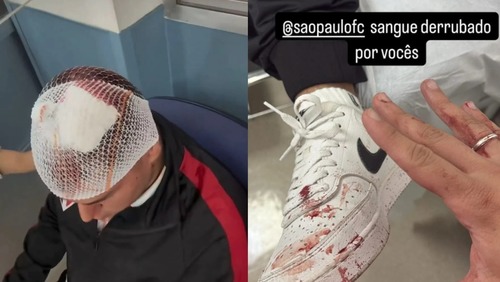 Torcedores acusam São Paulo de negligência após acidente com placa de ferro