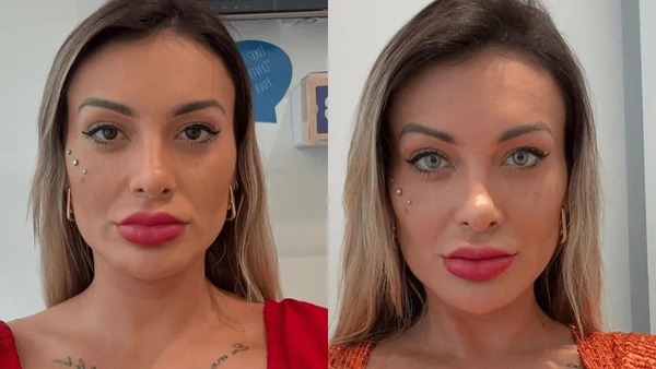 Após bifurcação, Andressa Urach faz cirurgia para mudar a cor dos olhos