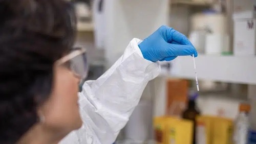 Butantan obtém patentes de dois testes rápidos para diagnóstico de leptospirose que oferecem resultados em 25 minutos