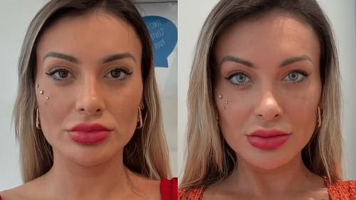 Andressa Urach enfrenta complicações após mudança na cor dos olhos
