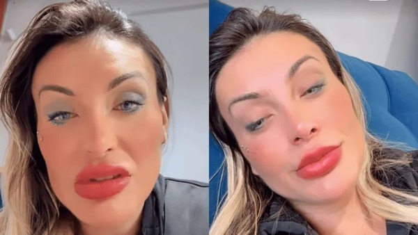 Arrependida, Andressa Urach lamenta cirurgia para mudar cor dos olhos: "Com medo de ficar cega"