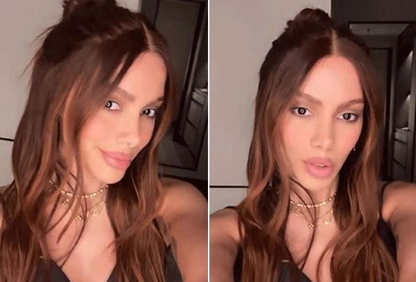 Anitta reaparece com "novo rosto" após sumiço das redes sociais e choca web; veja imagens
