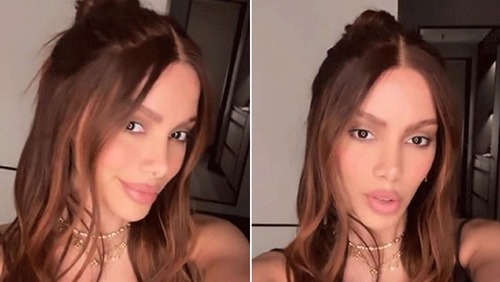 Anitta reaparece com "novo rosto" após sumiço das redes sociais e choca web; veja imagens