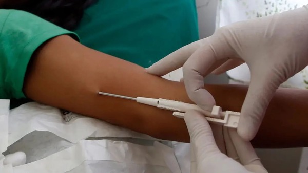 Ministério anuncia que SUS irá oferecer Implanon, implante contraceptivo de longa duração