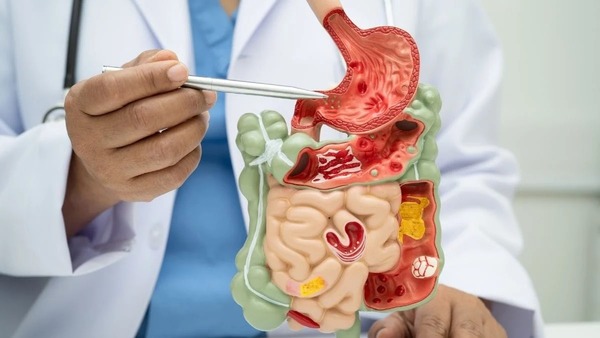 Uma pessoa é diagnosticada com câncer de intestino a cada 12 minutos no Brasil