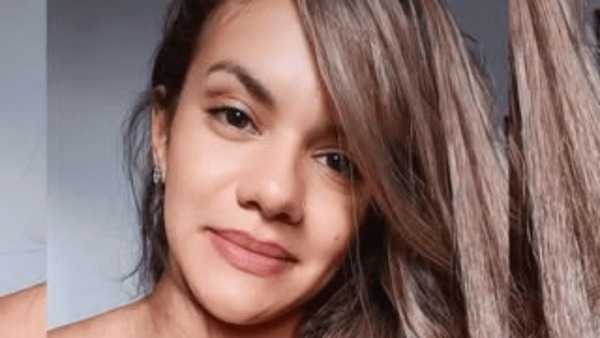Mulher agredida com 61 socos pelo namorado posta 1ª foto após cirurgia de reconstrução facial