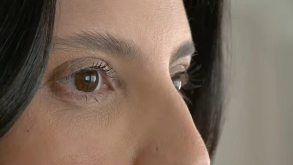 Conheça a blefaroplastia, a cirurgia plástica mais procurada do mundo