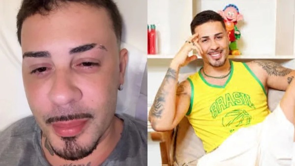 Carlinhos Maia surge nos stories com conjuntivite no fim do 'Rancho do Maia': 'Pifei'