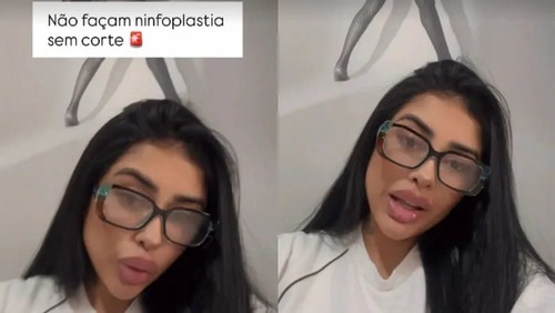 MC Medrado diz ter sofrido queimaduras de 3º grau após ninfoplastia sem cortes