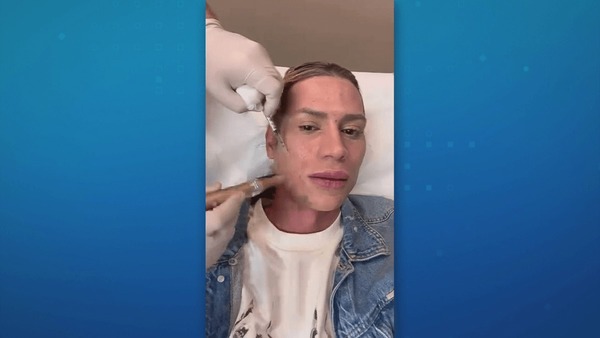 Influencer morre após complicações de procedimento estético no rosto em SP