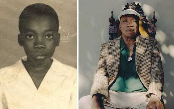 Milton Nascimento celebra 83 anos com doença que acomete 57 milhões no mundo