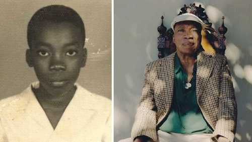 Milton Nascimento celebra 83 anos com doença que acomete 57 milhões no mundo