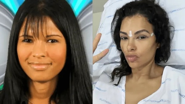 Ex-BBB Ariadna realiza cirurgia para feminização da voz em SP; saiba mais