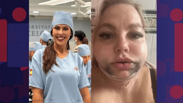 Dentista vira ré após paciente ter rosto deformado em procedimento estético