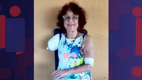 Justiça determina prótese biônica para escritora atacada por pitbulls