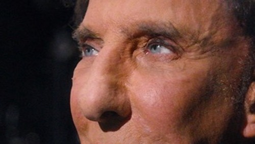 Barry Manilow, do hit 'Copacabana', revela diagnóstico de câncer no pulmão