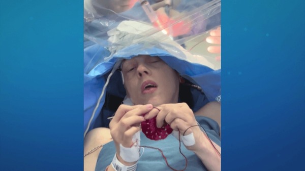 Mulher faz crochê durante cirurgia no cérebro no Paraná; veja