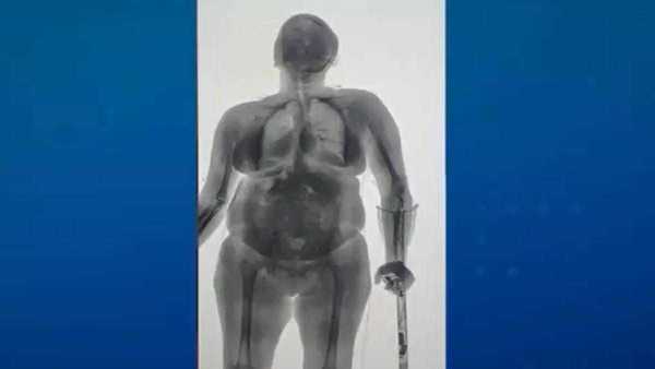 Mulher é flagrada com drogas escondidas em muleta e chinelo em cadeia