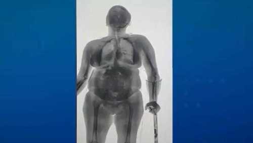 Mulher é flagrada com drogas escondidas em muleta e chinelo em cadeia