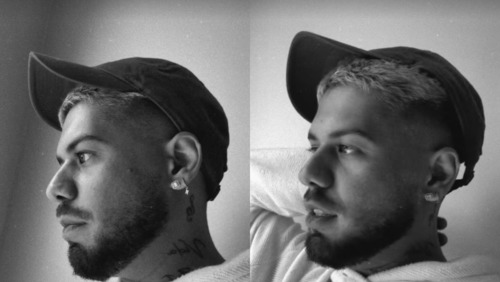 Zé Felipe desiste de tratamento após médico sugerir procedimento no ânus