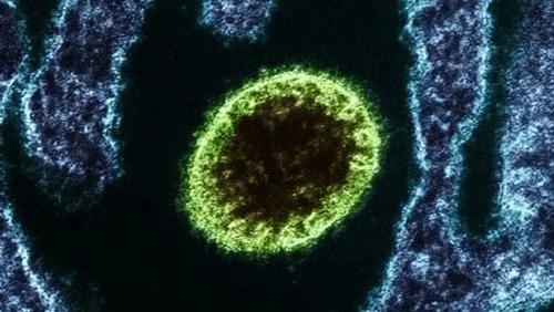 Com 71,7% de letalidade, vírus Nipah já causou mais de 300 mortes na Índia