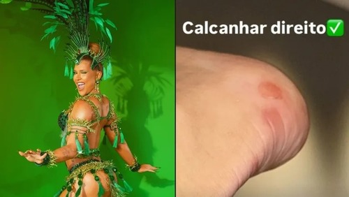 Virginia mostra machucados após ensaio na Grande Rio: 'Não existe mais pé'