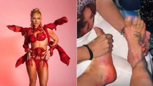 Virginia mostra pés machucados após ensaio da Grande Rio: 'Deus do céu'