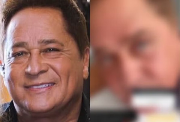 Poliana exibe resultado de cirurgia estética facial de Leonardo