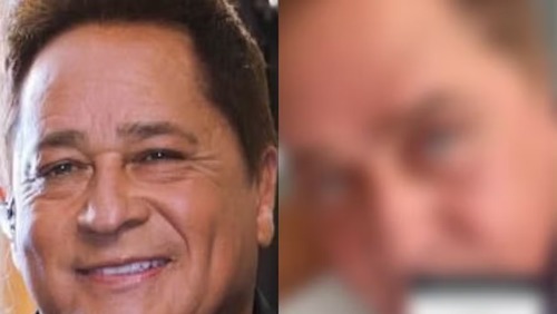 Poliana exibe resultado de cirurgia estética facial de Leonardo