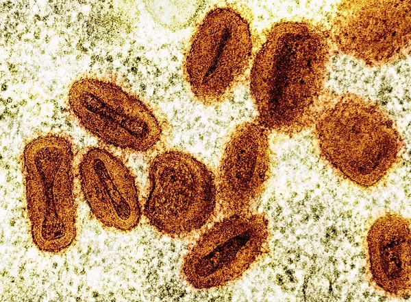 Brasil registra 88 casos de Mpox em 2026; saiba como evitar a doença