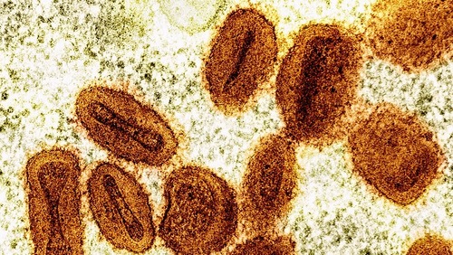 Brasil registra 88 casos de Mpox em 2026; saiba como evitar a doença