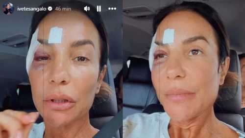 Ivete Sangalo tem alta após desmaio em casa e brinca: 'Maquiagem diferente'