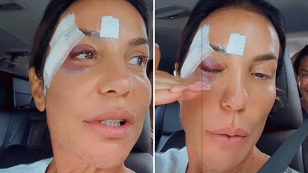 Saiba o que é síndrome vasovagal, que causou o desmaio de Ivete Sangalo