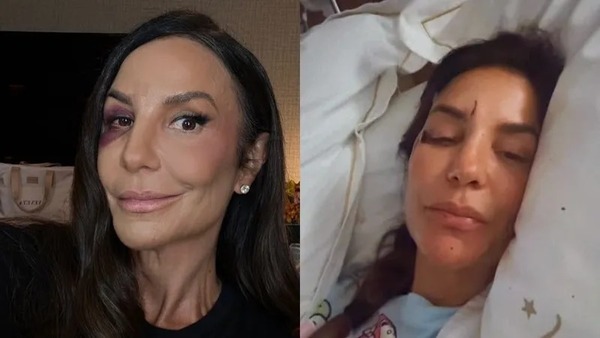 Ivete Sangalo passa por cirurgia de 7 horas após fratura na mandíbula