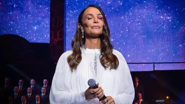 Ivete Sangalo recebe alta após cirurgia no rosto em São Paulo