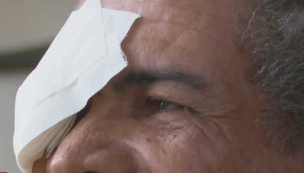 Vigilância suspende clínica após pacientes perderem a visão em Salvador