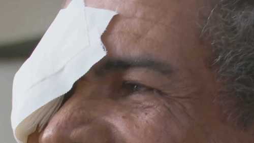 Vigilância suspende clínica após pacientes perderem a visão em Salvador