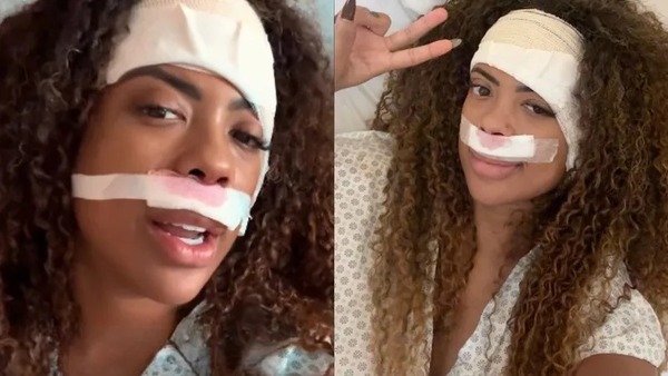 Cantora Marvvila retira tumor no ouvido e passa por cirurgia no nariz