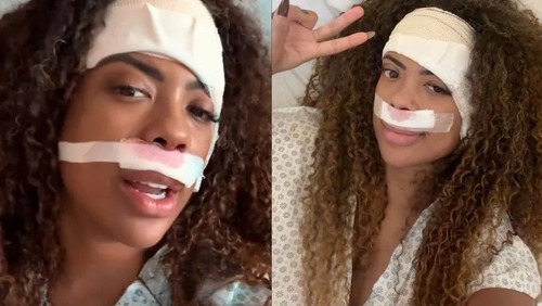 Cantora Marvvila retira tumor no ouvido e passa por cirurgia no nariz