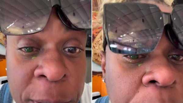 Cacau Protásio atualiza seguidores após perder visão com pomada de cabelo