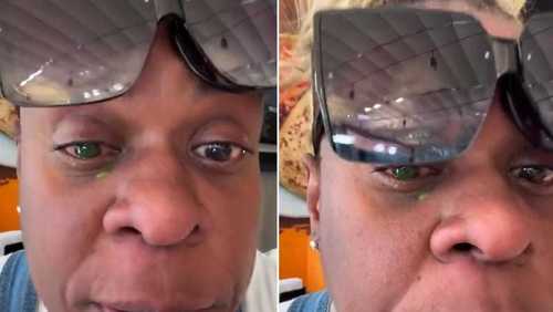 Cacau Protásio atualiza seguidores após perder visão com pomada de cabelo