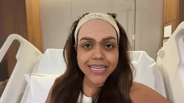 Camila Loures remove veia na testa com cirurgia: "Tinha que editar tudo"