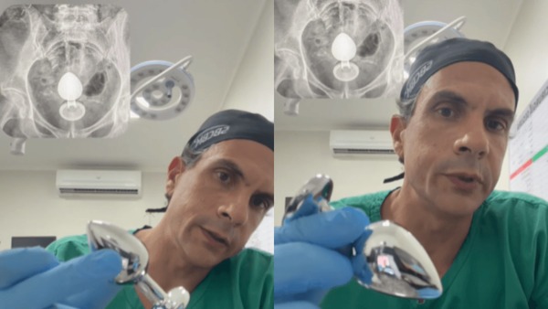 Mulher passa por cirurgia após plug anal parar no intestino