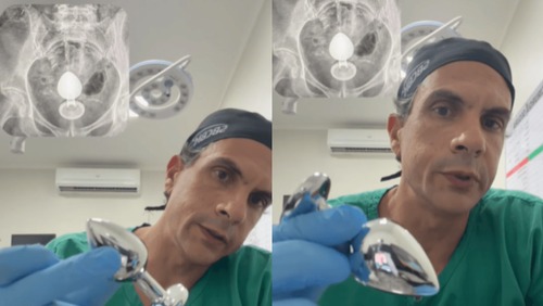 Mulher passa por cirurgia após plug anal parar no intestino