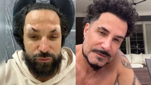 Latino nega harmonização facial após foto viralizar: "Foi apenas um filtro"